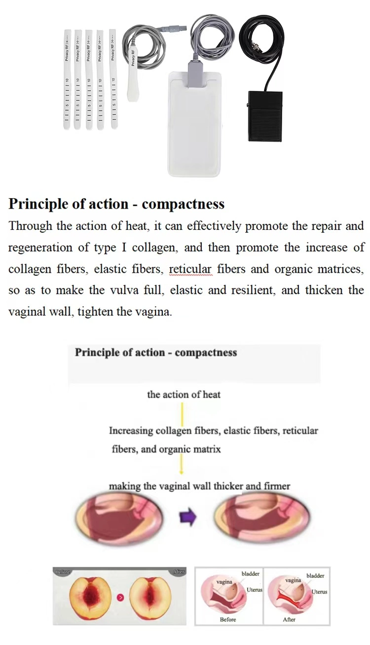 OEM Private Parts Care Postpartum Tightening Repair Fraction RF Machine Private Parts Care Beauty Device